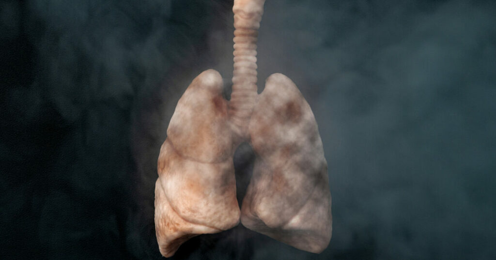 Danni al polmone